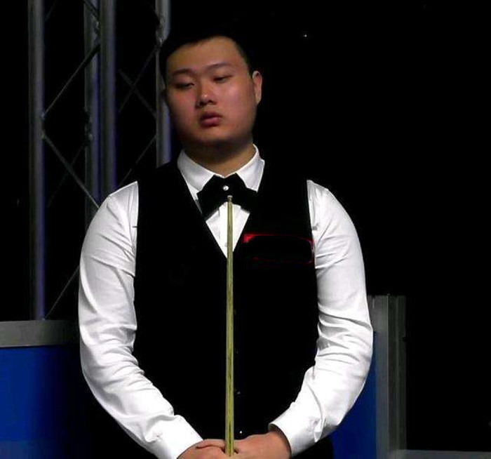 迪巴拉的伤 迪巴拉的伤